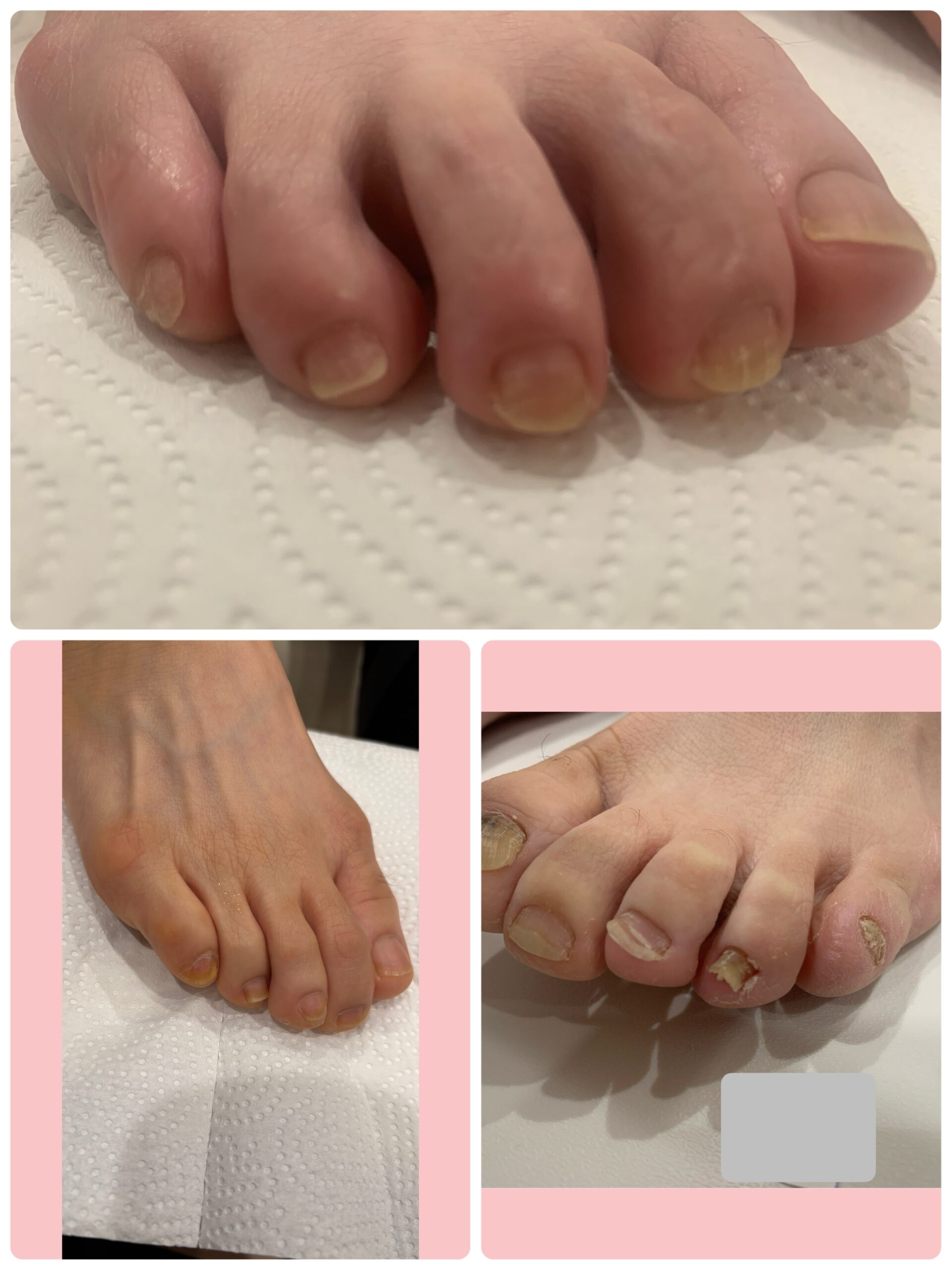 これら全てハンマートゥです